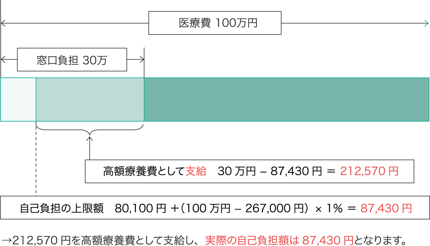 高額療養費として支給30万円−87,430円＝212,570円　自己負担の上限額80,100円＋（100万円−267,000円）×1％＝87,430円　→212,570円を高額療養費として支給し、実際の自己負担額は87,430円となります。